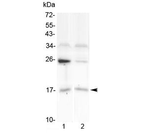 Western blot testing of human 1) U-87 MG and 2) placenta lysate with IL1F10 antibody at 0.5ug/ml. Pr