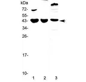 Western blot testing of 1) mouse heart, 2) mouse brain and 3) rat heart lysate with Il18bp antibody