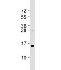 Western blot testing of human HT-1080 cell lysate with TAX1BP3 antibody at 1:2000. Predicted molecul