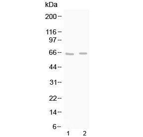 Western blot testing of 1) rat brain and 2) mouse brain lysate with GAD65 antibody at 0.5ug/ml. Pred