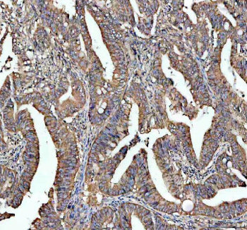 Immunohistochemical staining of STRIP1 using anti-STRIP1 antibody. STRIP1 was detected in a paraffin