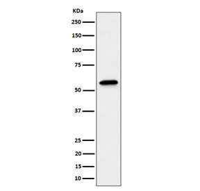 Western blot testing of human A431 cell lysate with SF3A3 antibody. Predicted molecular weight ~59 k
