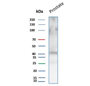 Western blot testing of human prostate tissue lysate with recombinant CD47 antibody (clone rCD47/658