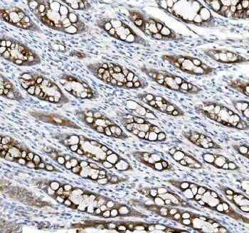 MUC5B Antibody
