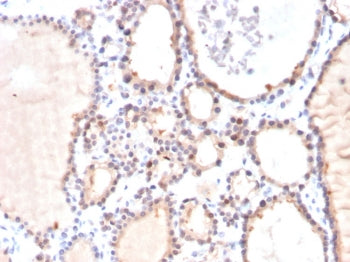 GLO1 Antibody / Glyoxalase I
