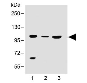 Western blot testing of human 1) 293T/17, 2) brain and 3) K562 lysate with SLC14A2 antibody at 1:500