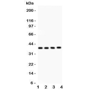 IkB beta Antibody