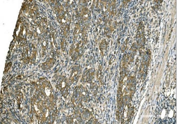 IHC staining of FFPE human renal pelvis squamous tissue with GOT1 antibody. HIER: boil tissue sectio