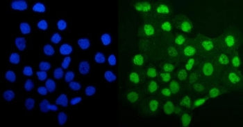 Immunofluorescent staining of FFPE human A431 cells with MCM4 antibody (green) and DAPI nuclear stai