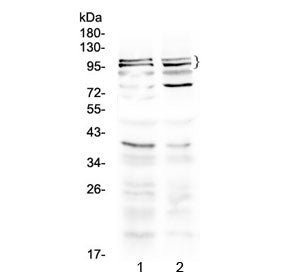 Western blot testing of 1) rat brain and 2) mouse brain lysate with TRPC3 antibody at 0.5ug/ml. Pred