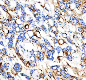 IHC analysis of FYCO1 using anti-FYCO1 antibody. FYCO1 was detected in a paraffin-embedded section o