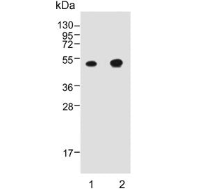 Western blot testing of 1) mouse stomach and 2) rat stomach lysate with CTSE antibody. Predicted mol