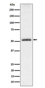 Western blot analysis of Phospho-Tau (S198) expression in mouse hippocampus cell lysate. The expecte