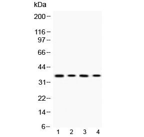 MC1 Receptor Antibody