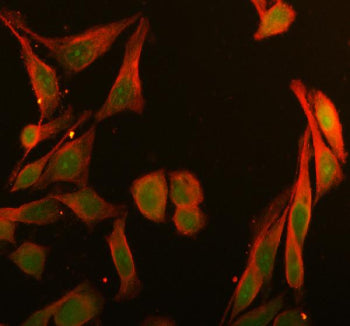 Immunofluorescent staining of BRD1 using anti-BRD1 antibody (green) and anti-Beta Tubulin antibody (