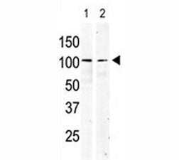 cKit antibody used in western blot to detect KIT in serum-starved HeLa cell lysate (lane 1) and prim