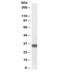 Western blot testing of A431 lysate with biotinylated SNAIL antibody at 0.1ug/ml. Predicted molecula