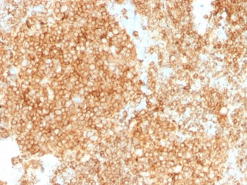 IHC staining of FFPE human tonsil with CD45 antibody. HIER: boil tissue sections in pH 9 10mM Tris w