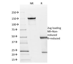 p21 Antibody / CDKN1A