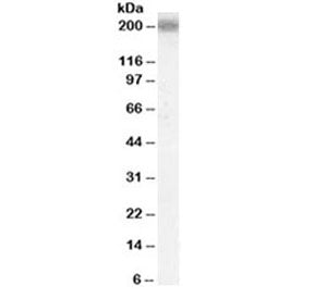 Western blot testing of human cerebral cortex lysate with LRP4 antibody at 0.1ug/ml. Predicted molec