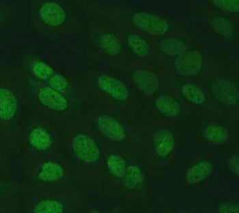 Immunofluorescent staining of FFPE human U-2 OS cells with SERINC2 antibody. HIER: steam section in
