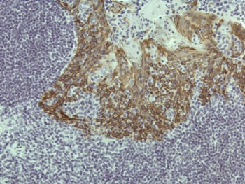 Cytokeratin 5 Antibody / KRT5