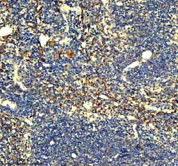 Immunohistochemical staining of Gp9 using anti-Gp9 antibody. Gp9 was detected in a paraffin-embedded