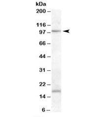 Western blot testing of human lung lysate with MARCH6 antibody at 0.2ug/ml. Both the ~100kDa specifi