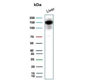Western blot testing of human liver tissue lysate with recombinant Carbamoyl phosphate synthetase 1