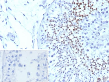 IHC staining of FFPE human testis tissue with Centrin 1 antibody (clone CETN1/9880). Inset: PBS used