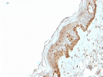 IHC staining of FFPE human skin with S100A2 antibody. HIER: boil tissue sections in pH6, 10mM citrat
