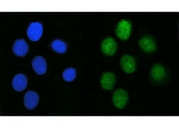 SAGE1 Antibody / CT14