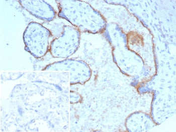 CD105 Antibody / Endoglin