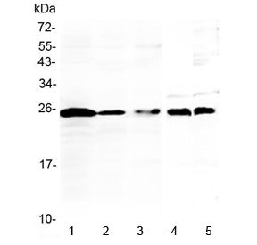 Western blot testing of 1) human Jurkat, 2) human K562, 3) human Raji, 4) rat thymus and 5) mouse th