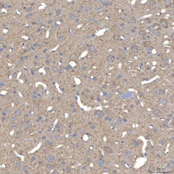 IHC staining of FFPE mouse brain tissue with SLC25A23 antibody. HIER: boil tissue sections in pH8 ED