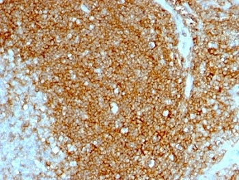 CD44 Antibody / HCAM