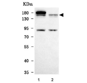 TIMELESS Antibody / TIM1 / TIM