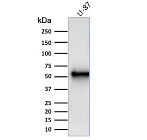 Western blot testing of human U-87 cell lysate with Vimentin antibody (clone V9). Predicted molecula