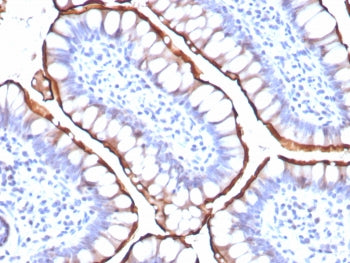IHC staining of FFPE human small intestine tissue with Angiotensin Converting Enzyme 2 antibody (clo