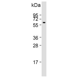 PI4K2A Antibody