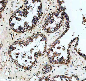 Immunohistochemical staining of PLIN5 using anti-PLIN5 antibody. PLIN5 was detected in a paraffin-em
