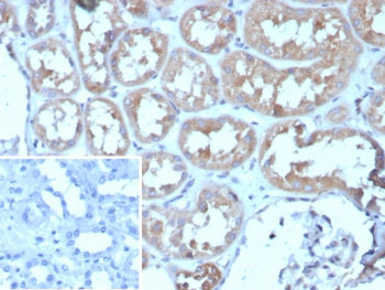 ADCY8 Antibody / Adenylyl cyclase 8
