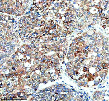 Immunohistochemical staining of HERC4 using anti-HERC4 antibody. HERC4 was detected in a paraffin-em