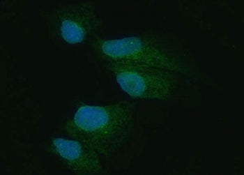 EIF2AK1 Antibody / Eukaryotic translation initiation factor 2-alpha kinase 1 / PKR