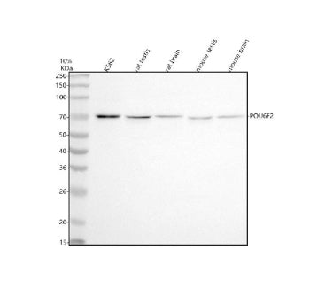 Western blot analysis of POU6F2 using anti-POU6F2 antibody. Electrophoresis was performed on a 10% S