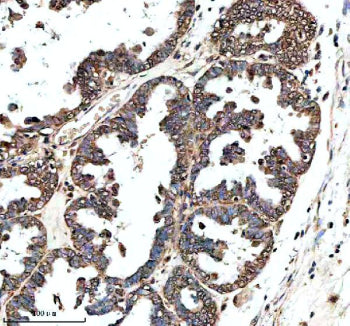 IHC analysis of GHRHR using anti-GHRHR antibody. GHRHR was detected in a paraffin-embedded section o
