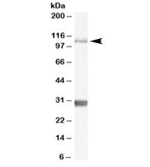 Western blot testing of mouse brain lysate with Insulin degrading enzyme antibody at 1ug/ml. The exp