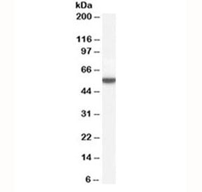 Western blot testing of human adipose lysate with Perilipin antibody at 0.01ug/ml. Predicted molecul