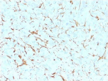 IHC analysis of formalin-fixed, paraffin-embedded human adrenal gland stained with NGF Receptor anti