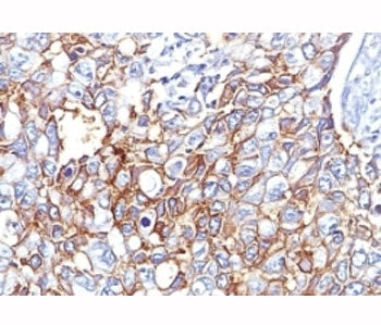 EpCAM Antibody